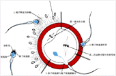 男性不育